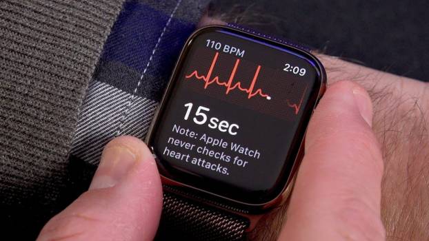 Появился новый способ включить ЭКГ на Apple Watch в России